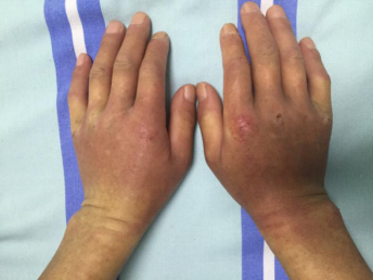 1574132541345058.png image.png