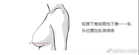 74249e70gy1foutjrr2yzj20d80590sn.jpg
