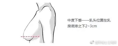 74249e70gy1foutk95ay6j20cw052q2u.jpg