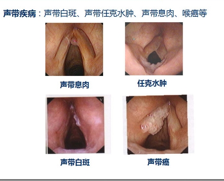 1576409310434623.jpg 17-45-43-mp47589970_1449707363513_7_mh1575021922540.jpg