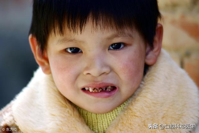 孩子换牙换得好不好，父母有不可推卸的责任！不要留下遗憾！