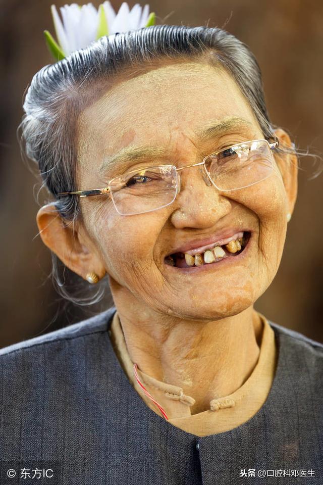 牙龈生病的常见5种疾病，你中招了吗？