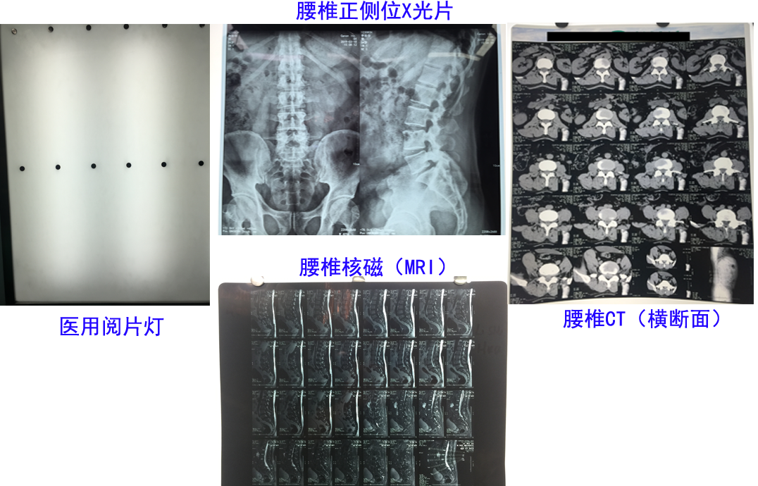 阅片灯.png