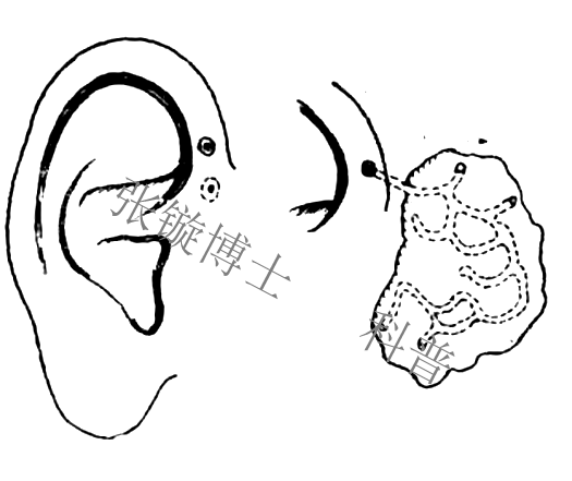 耳仓藏米