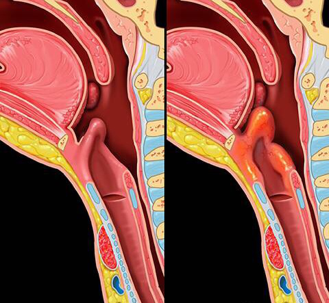 1578282529990800.png 90-1P424212450X5.png