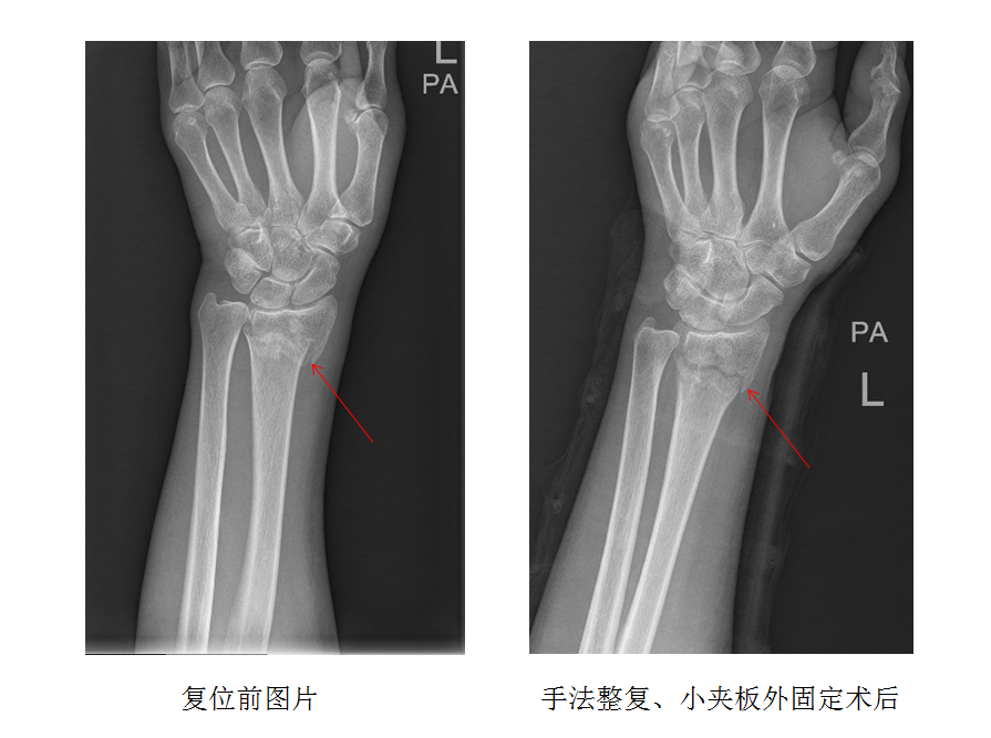 QQ截图20200111184627.png