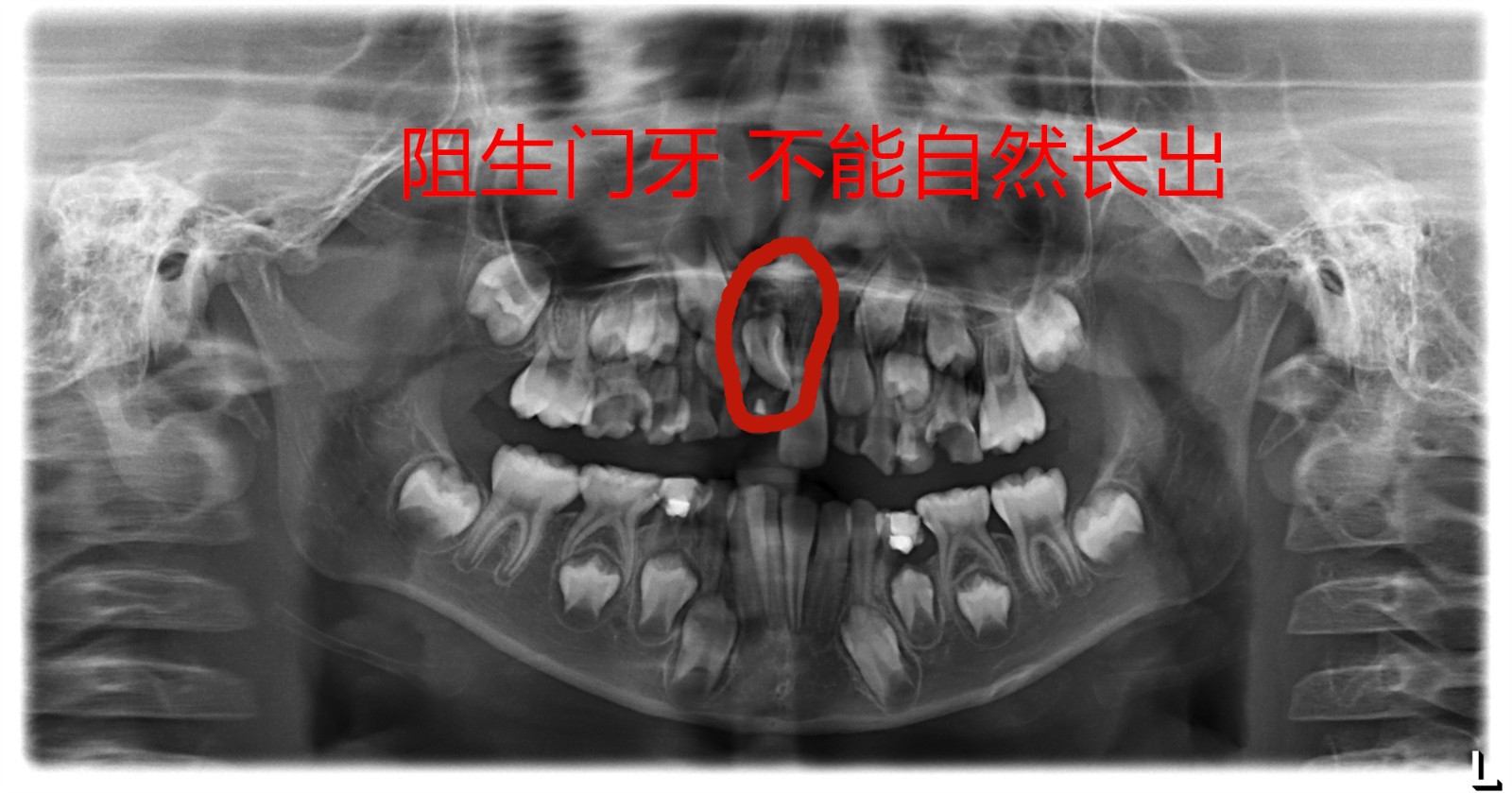 ______20110222_39787584_1_副本.jpg