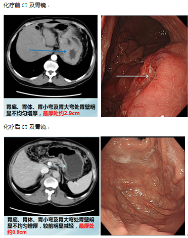 微信图片_20200130221949.png