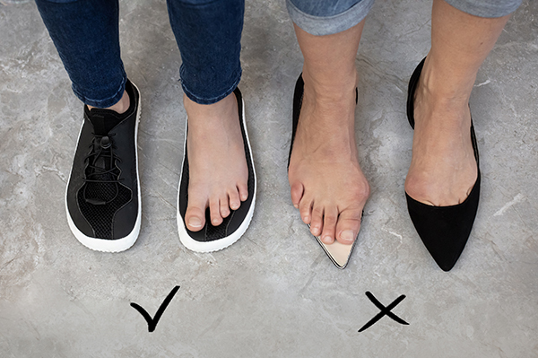 bunion_blog_image_2.jpg