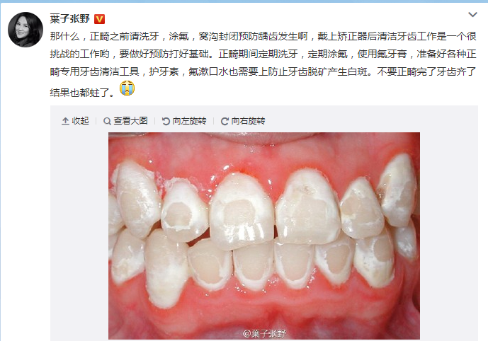 u=1892345744,3834063017&fm=15&gp=0.jpg.png