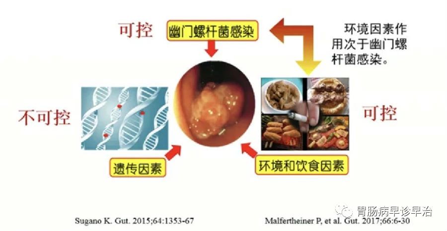 胃癌因素2.jpg