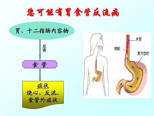 逆流而上的酸爽