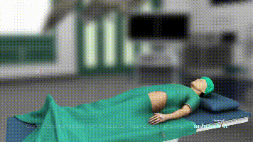 Core Decompression for Avascular Necrosis of the Hip from Your Practice Online on Vimeo (4).gif