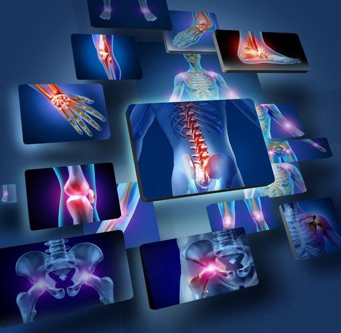 arthritis_17688042_m.jpg