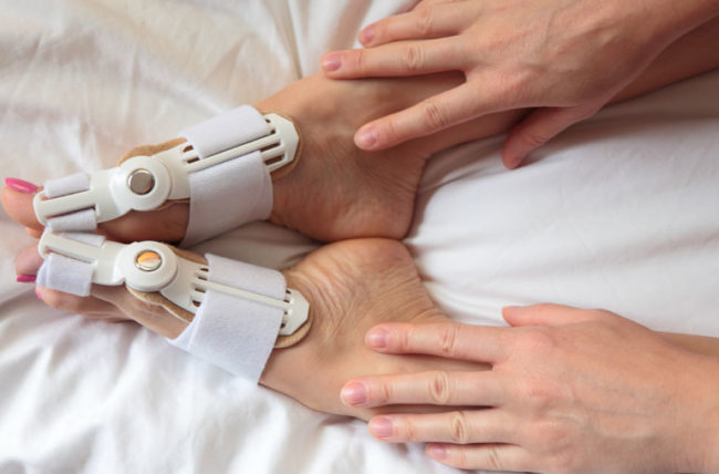 bunionSplints-696077160-770x553-650x428.jpg