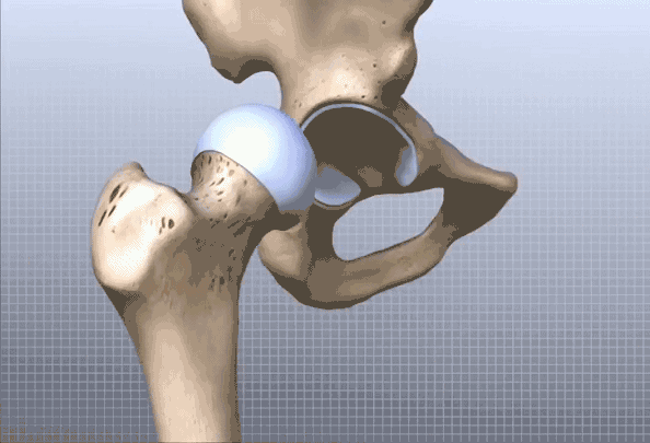 Hip-Anatomy-Animated-Tutorial20203181557151.gif
