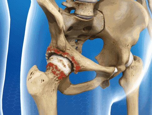 ViewMedica-8(1)20203181637594.gif