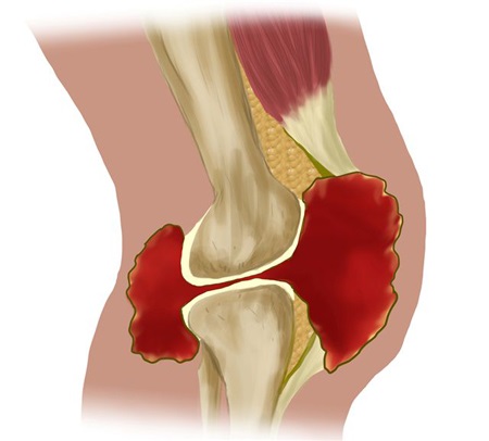 20120213_fig192.jpg