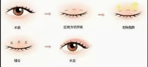 微信图片_20200402154905.png