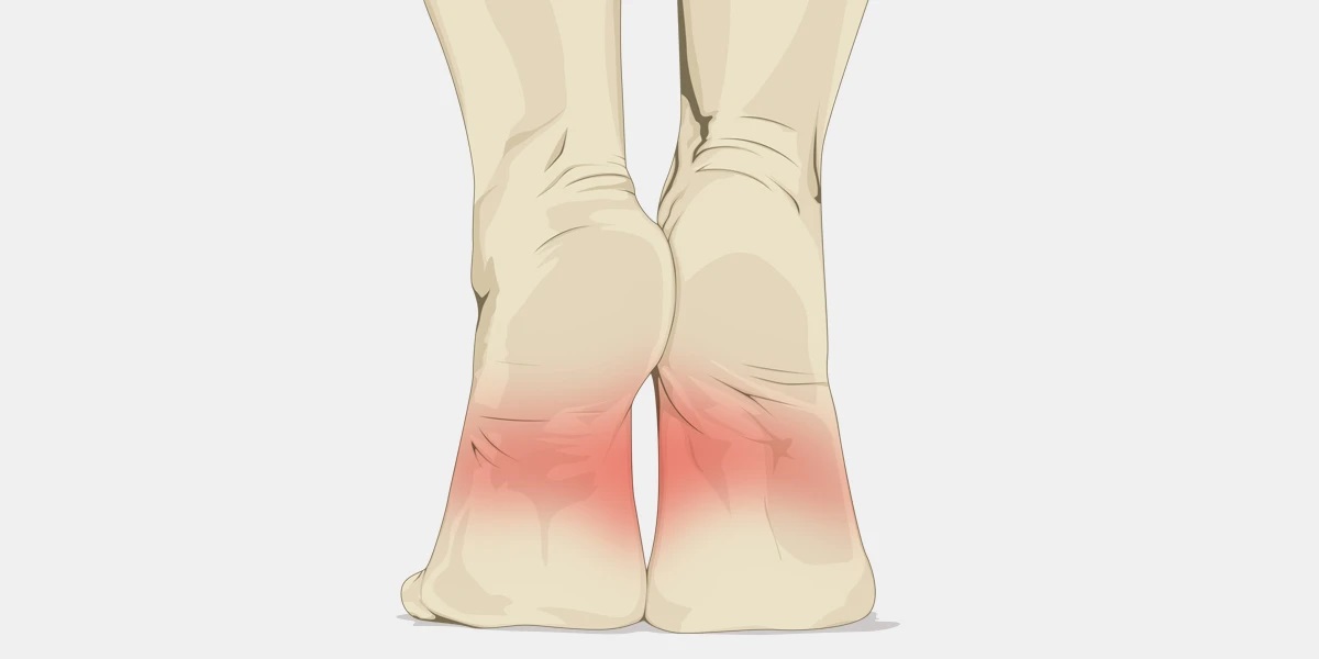 Pain-in-Arch-of-Foot-Illustration.jpg