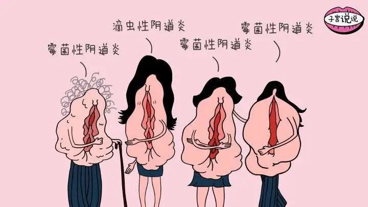 事实上女性妇科病的出现,与男性有一定关系,尤其是以下几类常见妇科病