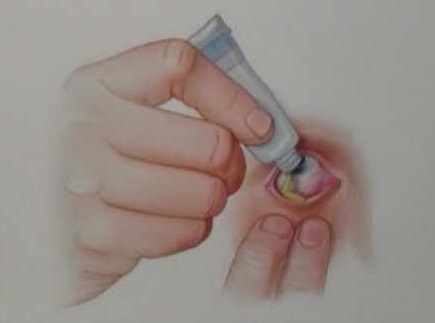 眼膏滴法.jpg