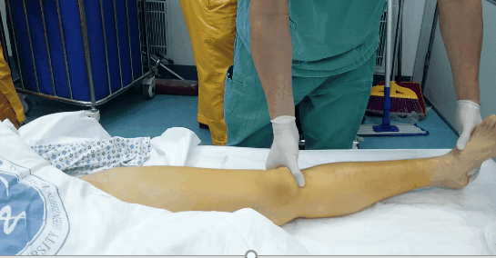 活动度2.gif