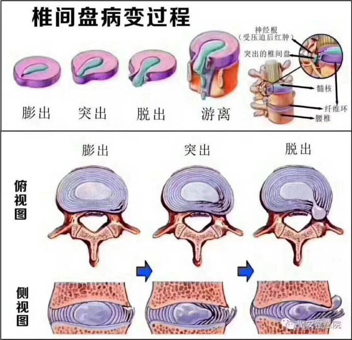 腰椎1~7节位置图图片