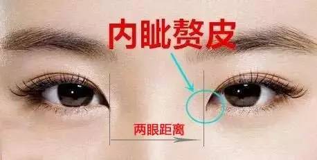 8kyH-fyqrewh6505914.jpg