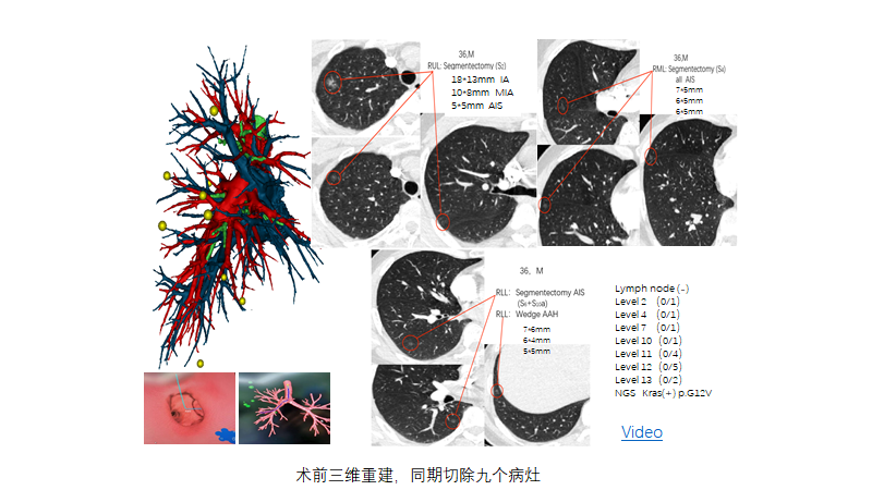 1587229670536832.png image.png