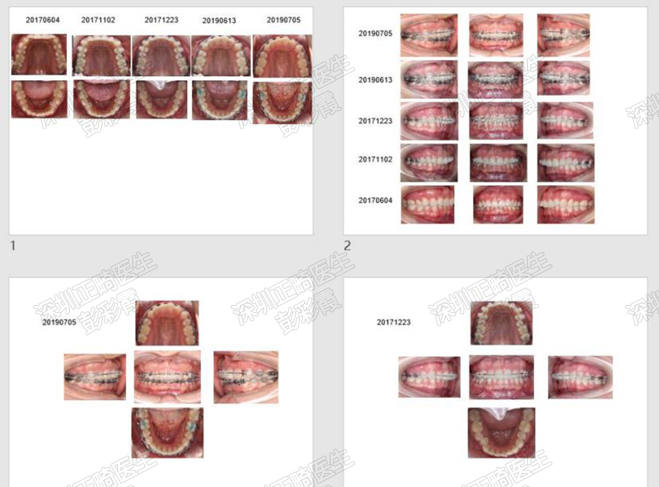 1587307606648153.jpg 5.jpg