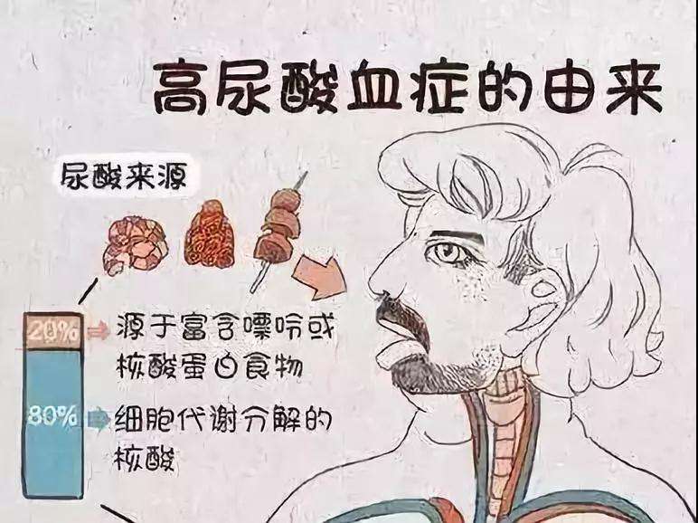 高尿酸血症痛风尿酸水平正常不是痛风血尿酸不是越低越好