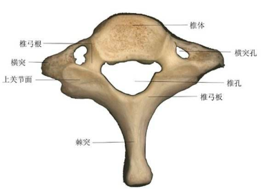图2  第一颈椎(寰椎)和第二颈椎(枢椎)图1 颈椎位于脊柱的颈段颈椎