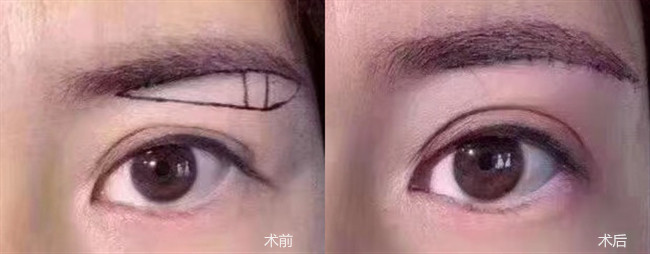1_副本.jpg