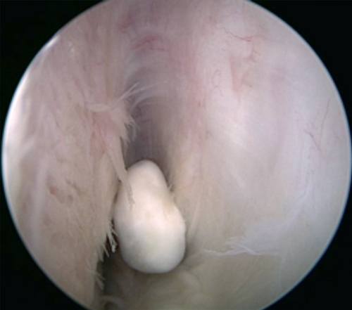 joint-mouse-corpus-liberum-arthroscopy.jpg