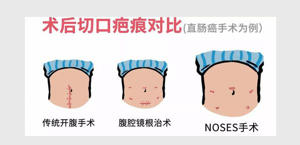 切口对比.png