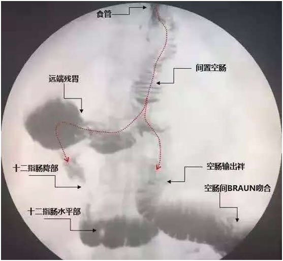 双通道X线照片.jpg