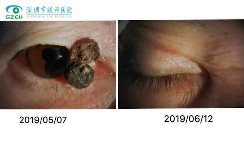 1589791308369147.png blob.png