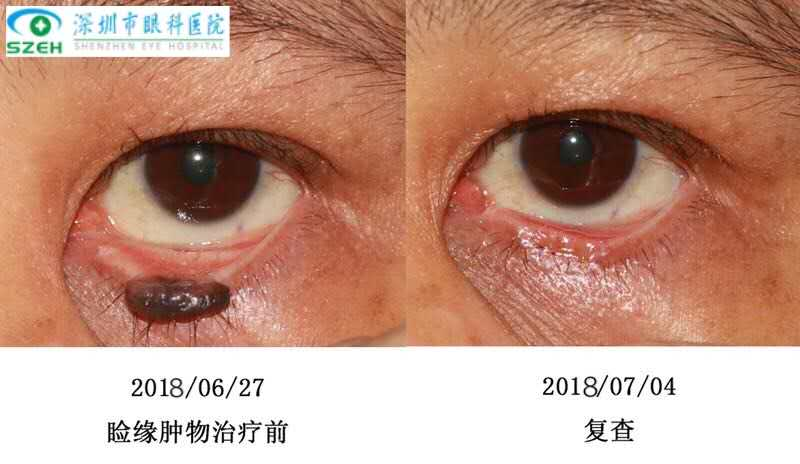 1589791318111029.png blob.png