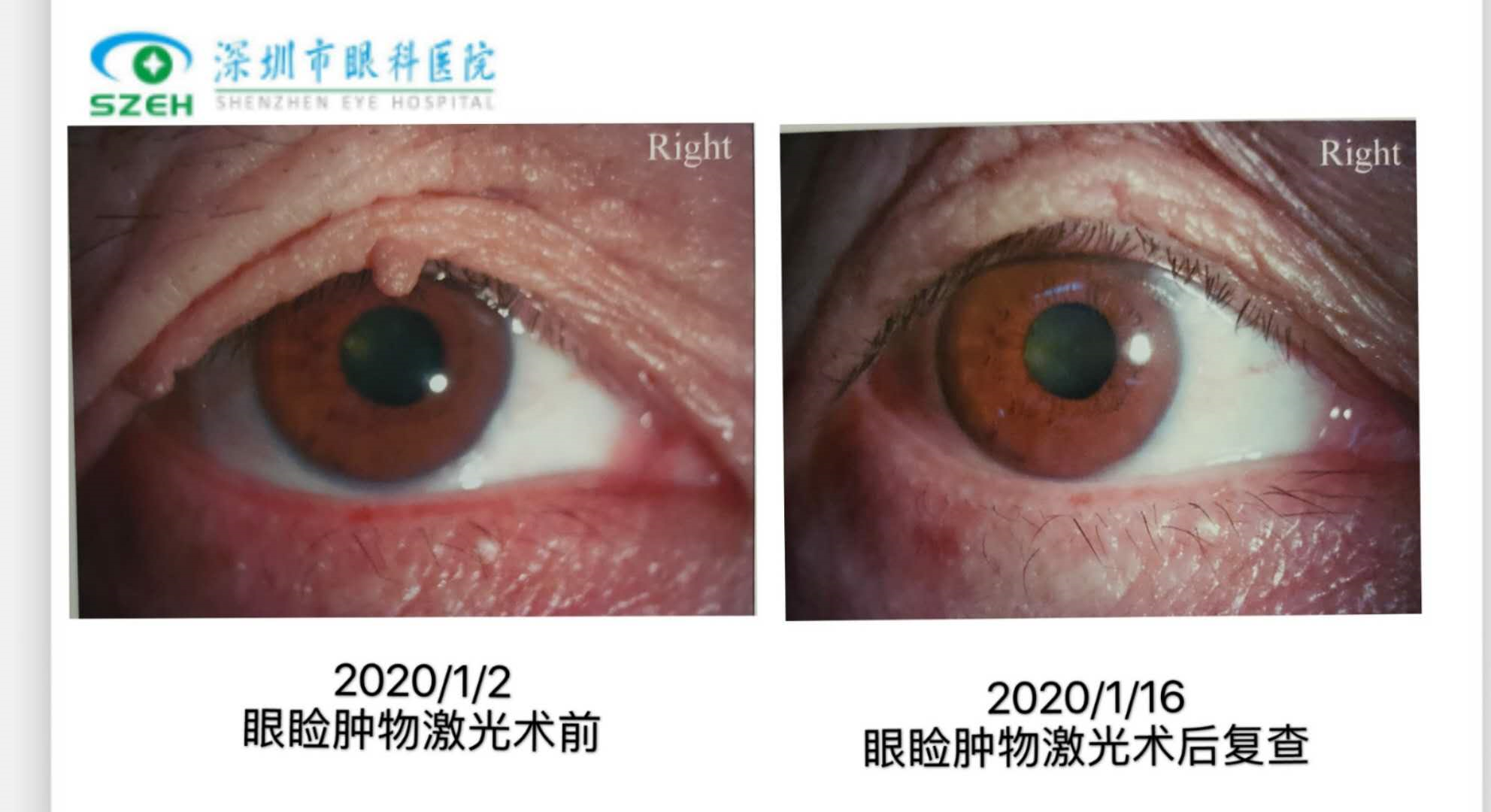 1589791342119811.png blob.png