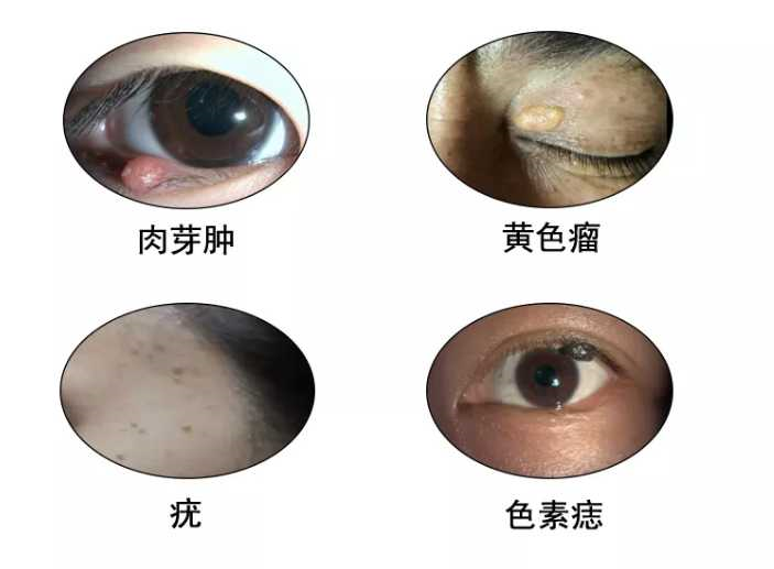 1589791436414440.png blob.png