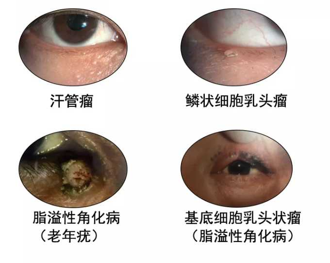 1589791444833626.png blob.png