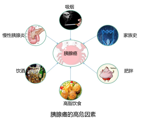 二,胰腺癌的临床表现有哪些?