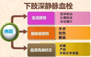名医专访 | 深圳市罗湖区人民医院黄智勇：什么是深静脉血栓？