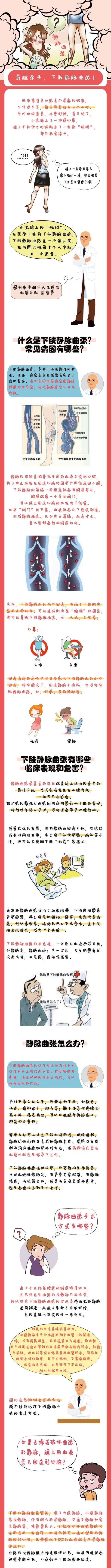 美腿杀手，下肢静脉曲张
