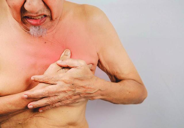 89岁男性得乳腺癌全切左乳！医生：男性也会得乳腺癌，有3大症状