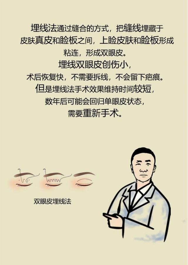 我适合做双眼皮手术吗？