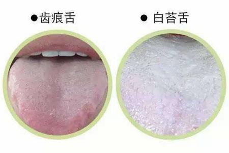 中医话痛风,你不知道的5种类型-健康160