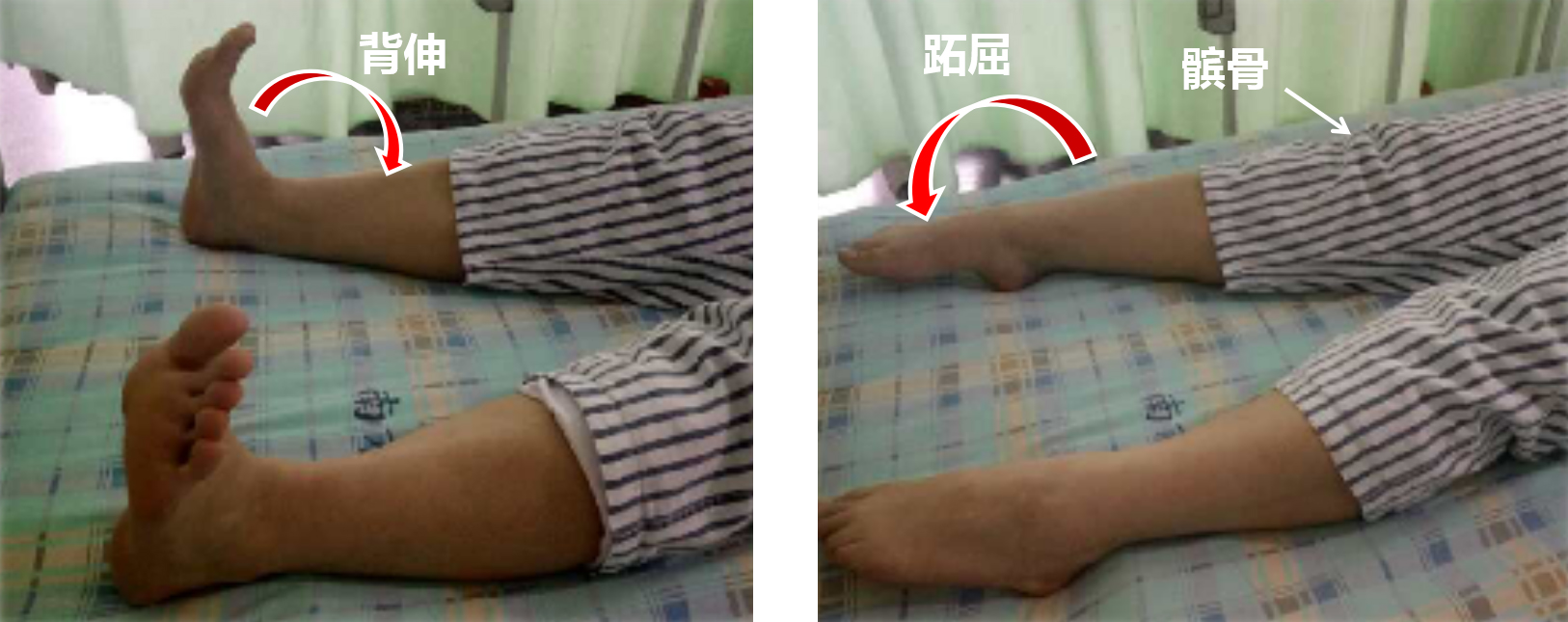 <!--HAODF:8:rengongguanjiezhihuanshu-->关节置换<!--HAODF:/8:rengongguanjiezhihuanshu-->的康复很重要：髋<!--HAODF:8:rengongguanjiezhihuanshu-->关节置换<!--HAODF:/8:rengongguanjiezhihuanshu-->手术后平常该如何锻炼？