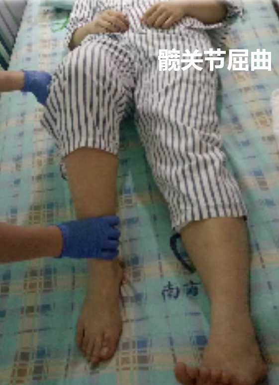 <!--HAODF:8:rengongguanjiezhihuanshu-->关节置换<!--HAODF:/8:rengongguanjiezhihuanshu-->的康复很重要：髋<!--HAODF:8:rengongguanjiezhihuanshu-->关节置换<!--HAODF:/8:rengongguanjiezhihuanshu-->手术后平常该如何锻炼？